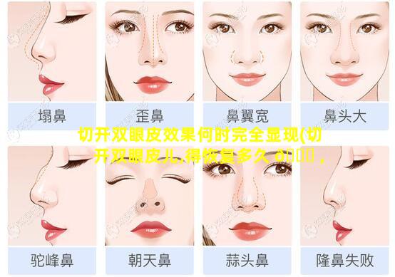 切开双眼皮效果何时完全显现(切开双眼皮儿,得恢复多久 🍀 ,需要注意什 🐧 么)